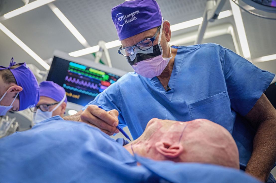 Dr. Eduardo Rodriguez, director of the Face Transplant Program at NYU Langone Health, performing a whole-eye and partial face transplantation surgery.